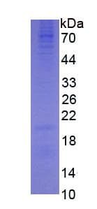 Human SHBG Protein (Recombinant His, N-Terminal)