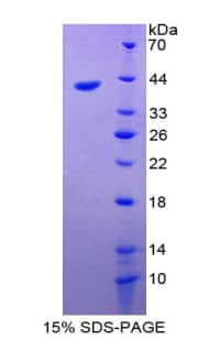 Rat CCL11 / Eotaxin Protein (Recombinant His-GST)