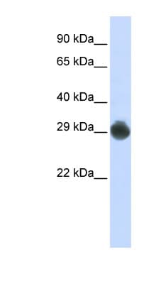 KITLG / SCF Antibody (aa180-229)