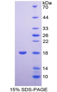 Chicken SDC4 / Syndecan 4 Protein (Recombinant His-T7)