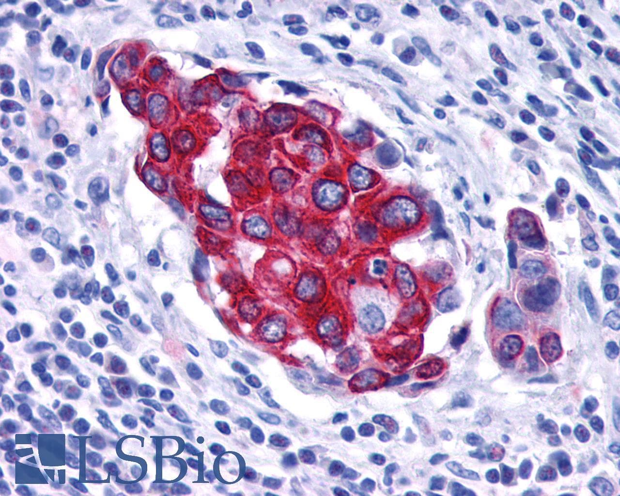 PathPlus™ VPAC2 / VIPR2 Antibody (C-Terminus)