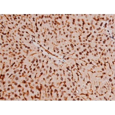 STAT3 Antibody (phospho-Tyr705)