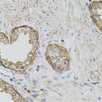 PLK4 / SAK Antibody