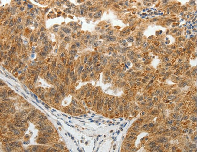 SOCS7 / SOCS-7 Antibody