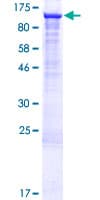 Human UBE2O Protein (Recombinant GST)