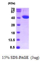 Human SCAD / ACADS Protein (Recombinant His)