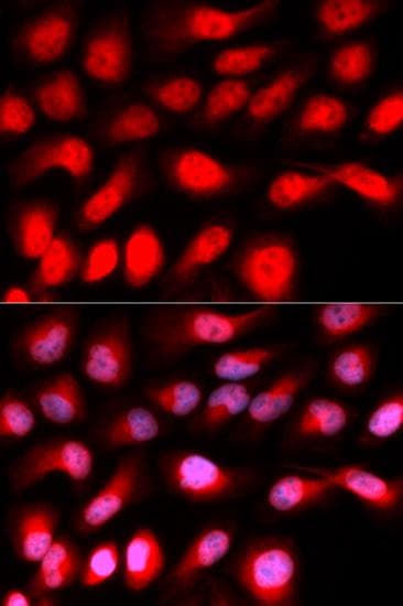 ZEB1 / AREB6 Antibody