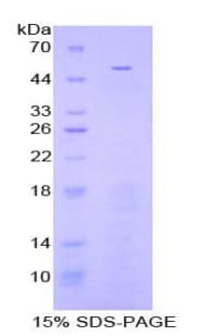 Mouse FGB / Fibrinogen Beta Chain Protein (Recombinant His)