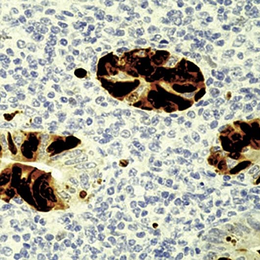 Monoclonal Mouse anti-Adenovirus Adenovirus Antibody (clone M58+M73, IHC)
