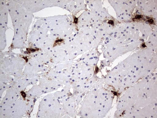 Monoclonal Mouse anti-Human SMPD1 / Acid Sphingomyelinase Antibody (clone OTI3H7, aa62-341, IHC, WB)