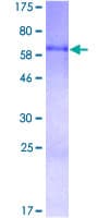 Human CYR61 Protein (Recombinant GST)
