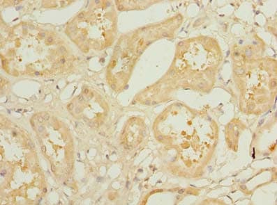 KLHL42 / KLHDC5 Antibody