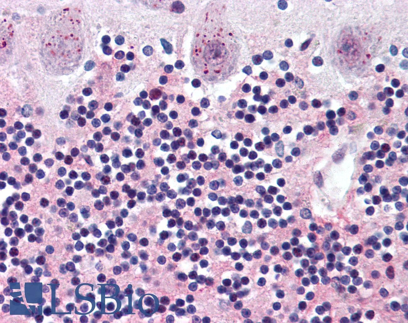 IHC-plus™ Polyclonal Rabbit anti-Human WNT2 / IRP Antibody (Internal, IHC)