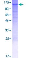 Human NUP210 / gp210 Protein (Recombinant GST)