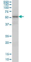 VRK2 Antibody (clone 3B10)