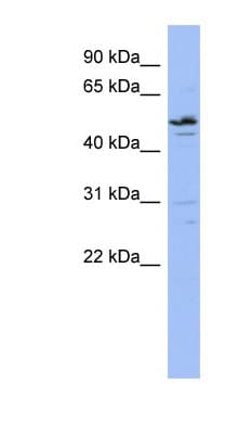 Polyclonal Rabbit anti-Human ZNF419 Antibody (aa107-156, WB)