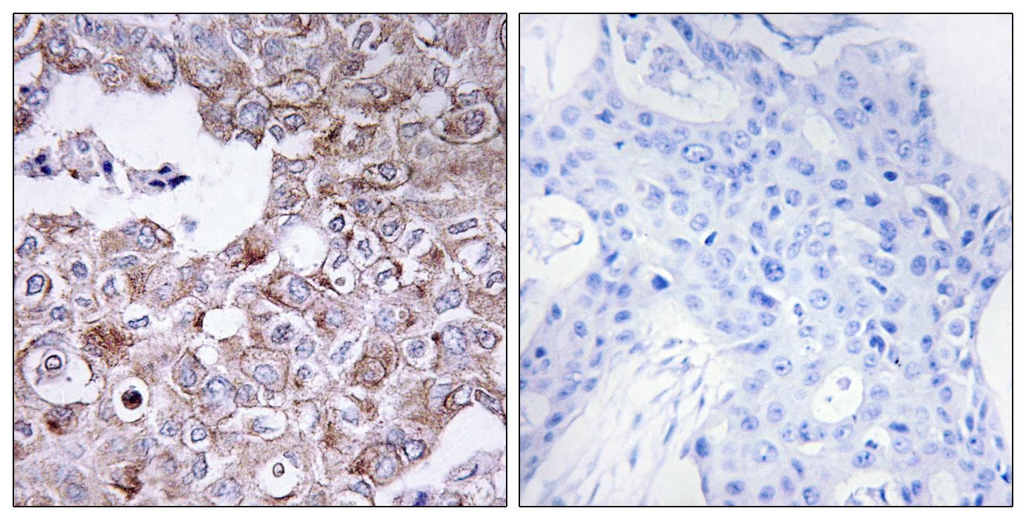 Polyclonal Rabbit anti-Human EMA / MUC1 Antibody (IHC, IF)