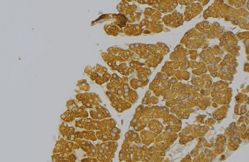 Polyclonal Rabbit anti-Human KLK12 / Kallikrein 12 Antibody (IHC, WB)