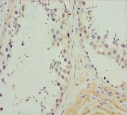Polyclonal Rabbit anti-Human NCALD / Neurocalcin Delta Antibody (IHC)