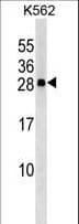 CXXC4 Antibody (aa158-185)