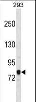 Polyclonal Rabbit anti-Human ACSL3 Antibody (aa528-556, WB)