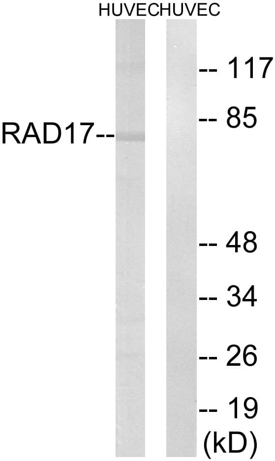 RAD17 Antibody (aa621-670)