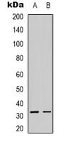 ACER3 Antibody (Internal)
