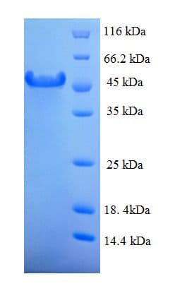 Human HABP2 Protein (Recombinant His-SUMO)