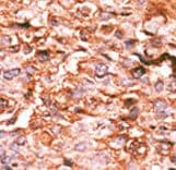 Polyclonal Rabbit anti-Human HIST1H3E Antibody (phospho-Ser10, IHC, WB)
