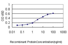 S100A1 / S100-A1 Antibody (clone 1D5)