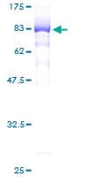 Human EIF5 Protein (Recombinant GST)