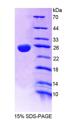 Human TASP1 Protein (Recombinant His-T7)