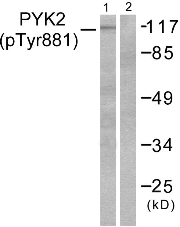 PTK2B / PYK2 Antibody (phospho-Tyr881)