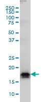 IHC-plus™ Monoclonal Mouse anti-Human AGTRAP / ATRAP Antibody (clone 1G2, IHC, WB)