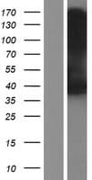 SLC37A2 Protein (Over-Expression Lysate Myc-DDK (Flag))