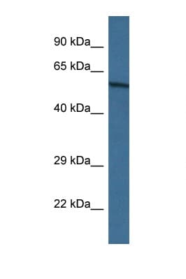ASIC1 / ACCN2 Antibody (N-Terminus)