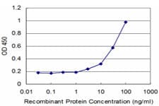 PFK2 / PFKFB3 Antibody (clone 3F3)