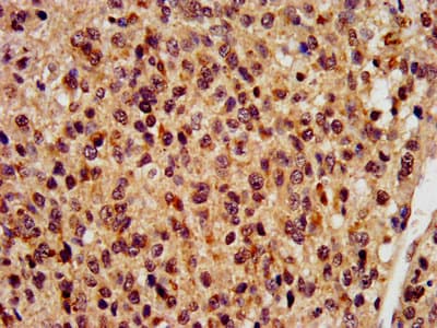 RBFOX2 / RBM9 Antibody