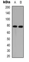 DNAI1 Antibody (Internal)