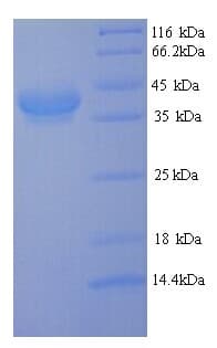 E. coli CFA/I Fimbrial Subunit E Protein (Recombinant His)