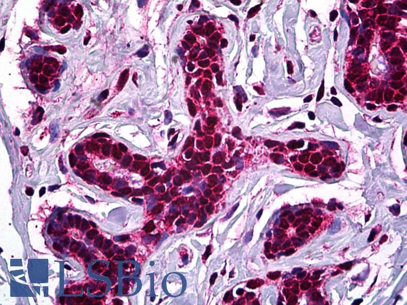 IHC-plus™ Monoclonal Mouse anti-Human STAG1 / SA1 Antibody (clone 2E9, IHC, IF, WB)