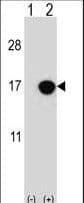 Polyclonal Rabbit anti-Human CDKN2B / p15 INK4b Antibody (aa102-130, IHC, IF, WB)