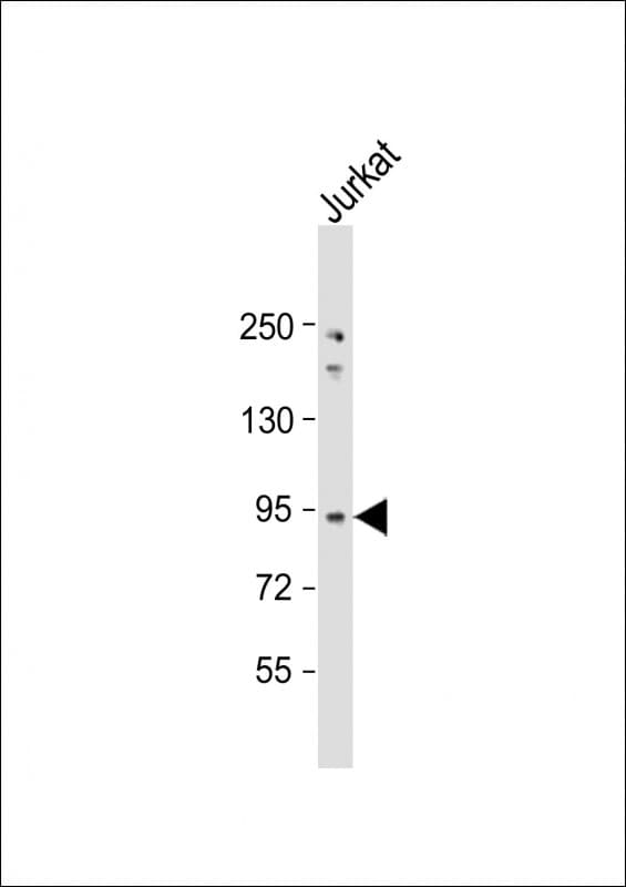 Polyclonal Rabbit anti-Human NUP93 Antibody (aa752-782, WB)