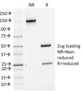 BCL6 Antibody (clone BCL6/1475)