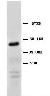 Polyclonal Rabbit anti-Human Basigin / Emmprin / CD147 Antibody (aa186-203, WB)