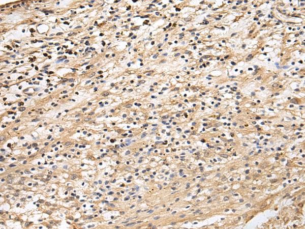 Polyclonal Rabbit anti-Human CRACR2A / EFCAB4B Antibody (IHC)