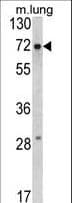 FMR1 / FMRP Antibody (aa20-48)