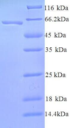 Human SMARCA2 / BRM Protein (Recombinant 6His, N-terminus)