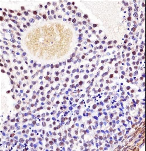 WEE1B / WEE2 Antibody (aa364-393)