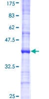 Human UBE3B Protein (Recombinant GST, N-terminus)